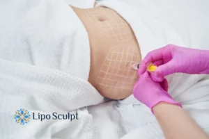 Are The Results From Aqualyx Permanent? 1 Do you want to know how long Aqualyx Somerset results last?