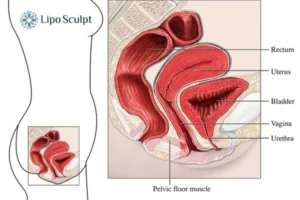 Treatment For A Leaky Bladder 2 How EM Chair treatment Somerset can help Leaky bladder issues. Read more now!