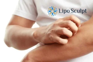 Best Actinic Keratoses Removal 4 prevent your actinic keratoses Somerset getting worse - call our team today!