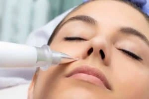 Best Actinic Keratoses Removal 3 Actinic keratoses Somerset solutions - book in today!