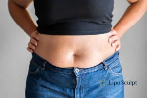 Bidding Farewell to Muffin Tops with Aqualyx Fat Injections 2 Do you wish you could reduce your muffin top Somerset With Aqualy fat dissolving injections you can!